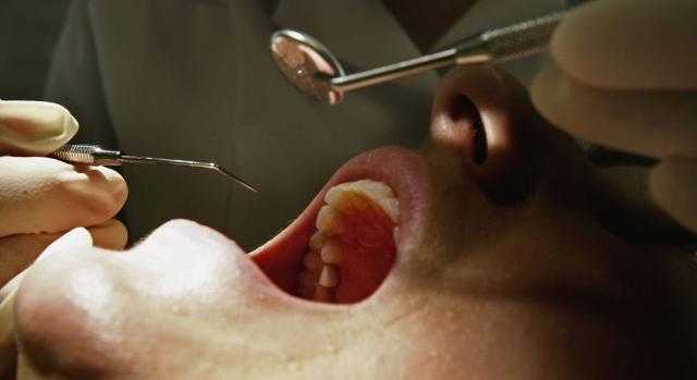 علامات في تجويف الفم و سببها هو امراض خطيرة